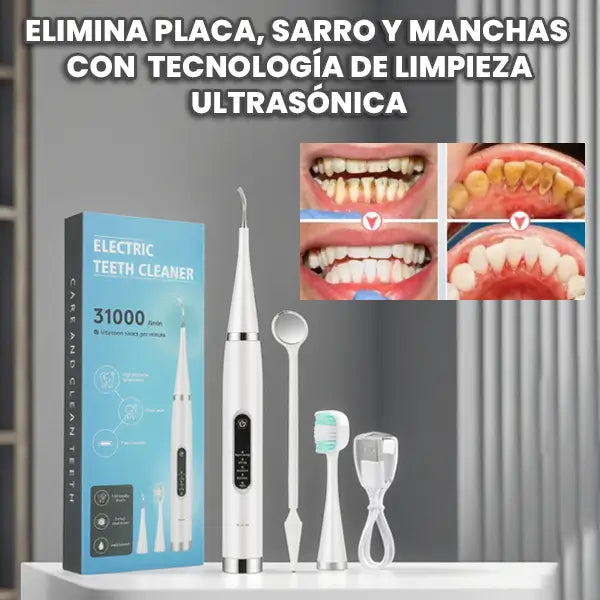 Kit completo removedor sarro– Sonríe con Confianza